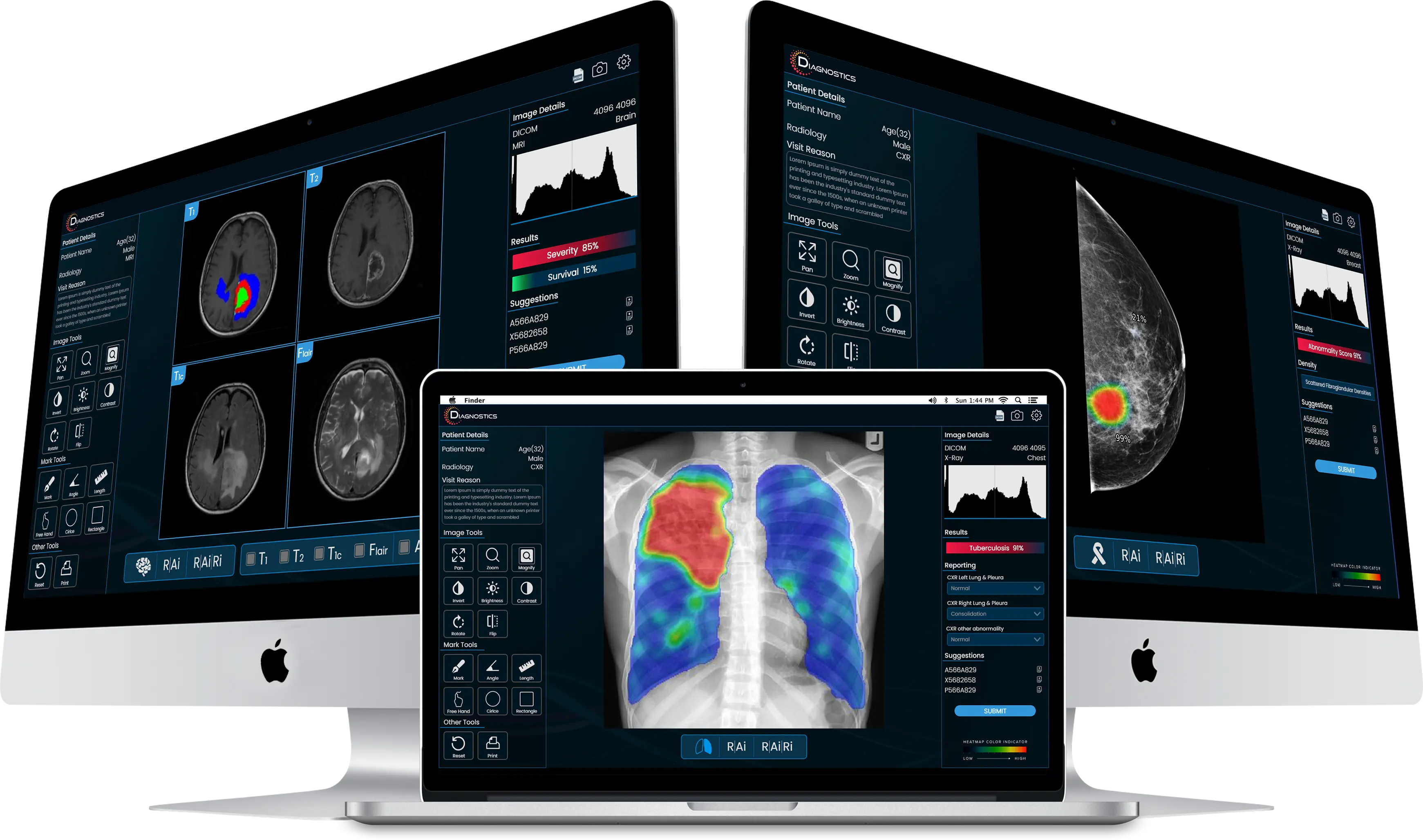 Attention-guided multimodal CEST MRI model for TP vs RN